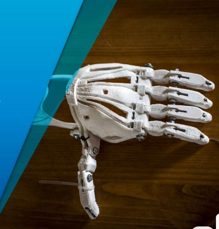 Advanced bionic prosthetic arm